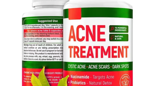 Acne Treatment