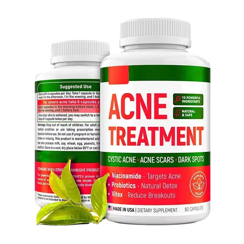 Acne Treatment
